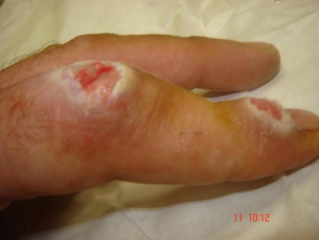 post-98524-0-12321000-1424385156_thumb.jpg