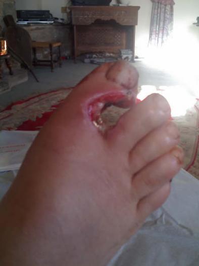 post-41670-0-18456800-1331154259_thumb.jpg