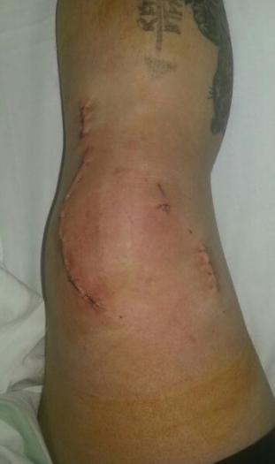 post-15090-0-40068000-1395391344_thumb.jpg