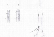 Quick Snare Securing Methods Fox Snare Quick Anchor