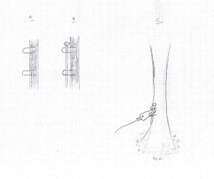 Fox Snare Quick Anchor Fox Snare Quick Anchor