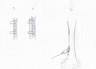 Quick Snare Securing Methods Fox Snare Quick Anchor